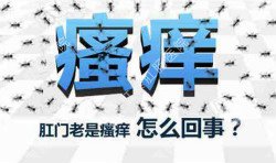 肛門瘙癢治不好嗎？先檢查病因就好辦！